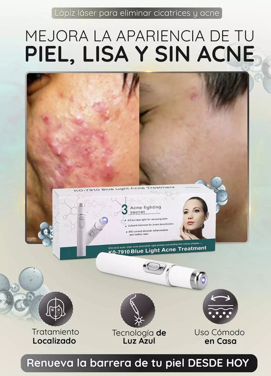 blue light acne treatment